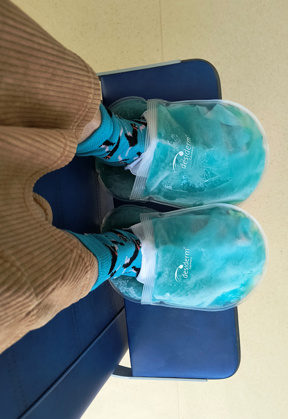 erste Chemotherapie-Sitzung mit Kühlpads an Händen und Füßen